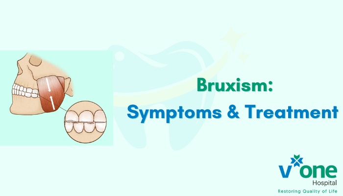 Bruxism - Teeth Grinding, Symptoms and Treatment