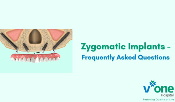 Zygomatic Implants Procedure - Frequently Asked Questions