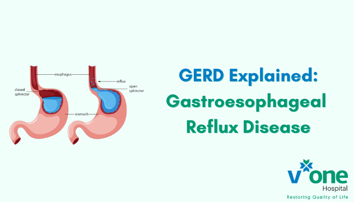 GERD - Gastroesophageal Reflux Disease by Top Gastroentrologist in Indore