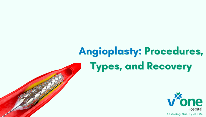 Angioplasty - types, procedures and recovery