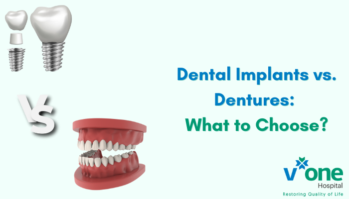 Dental Implants vs. Dentures by Dental Surgeon in Indore