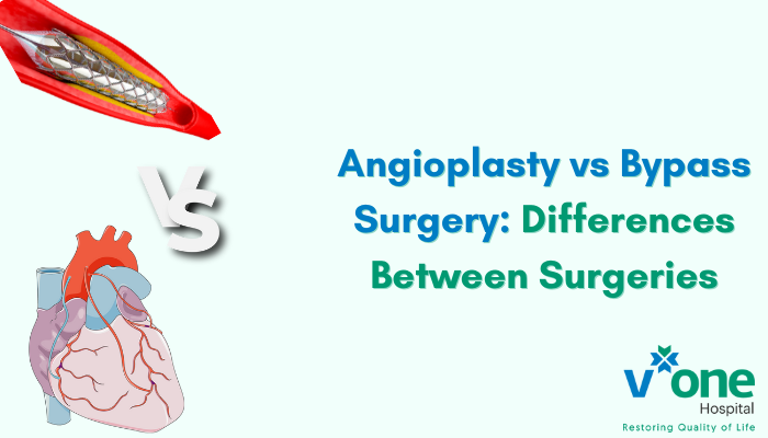 Angioplasty vs Bypass Surgery - Differences by Top Cardiologist in Indore at V One Hospital